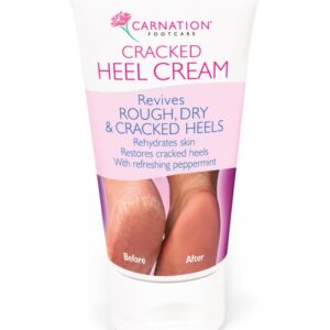 CARNATION CRACKED HEEL CREAM